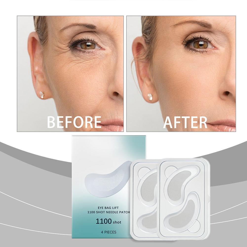 Hyaluronic Acid Microneedle Ey - Microneedle Patch Eye review and price